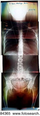 body, concept, bone, Body part, anatomy View Large Photo Image Stock Photography - body, concept, bone, Body part, anatomy. Fotosearch