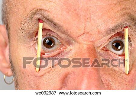 Close up of man keeping eyes wide open with match sticks View Large Photo Image Stock Photo - Close up of man keeping eyes wide open with match sticks. Fotosearch
