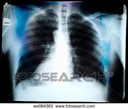 concept, black and white, bone, Body part, body, anatomy View Large Photo Image Stock Image - concept, black and white, bone, Body part, body, anatomy. Fotosearch