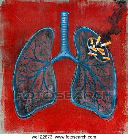 イラスト の 肺 そして タバコ ストックイメージ We Fotosearch