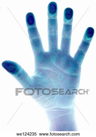 Direct negative scanned palm for verification isolated on white background. View Large Photo Image Stock Photography - Direct negative scanned palm for verification isolated on white background.. Fotosearch