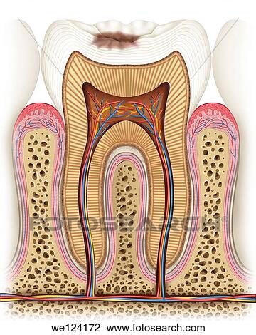 This teaches us a cari? image state in which it begins to erode the enamel on the crown of the tooth, it will continue growing as the days go if the patient does not visit your dentist View Large Photo Image Stock Image - This teaches us a cari? image state in which it begins to erode the enamel on the crown of the tooth, it will continue growing as the days go if the patient does not visit your dentist. Fotosearch