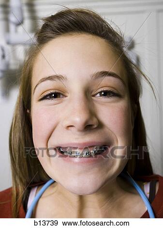 Stock Photo - Girl with braces smiling. Fotosearch