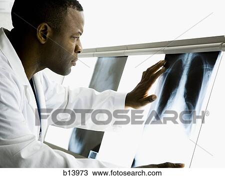 Stock Image - Male doctor looking at chest x-rays. Fotosearch