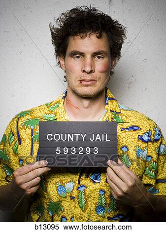 Stock Photography - Mug shot of man in Hawaiian shirt with cuts and scrapes. Fotosearch