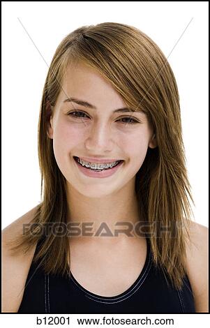 Stock Image - Smiling girl with braces. Fotosearch