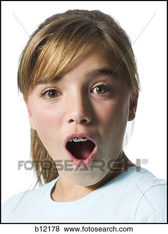 Stock Photo - Smiling girl with braces. Fotosearch