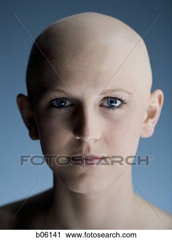 Bald woman View Large Photo Image Stock Image - Bald woman. Fotosearch