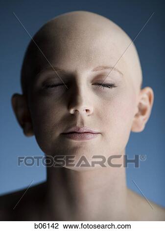Bald woman View Large Photo Image Stock Image - Bald woman. Fotosearch
