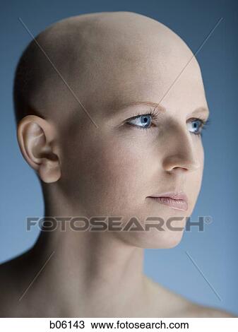 Bald woman View Large Photo Image Stock Image - Bald woman. Fotosearch