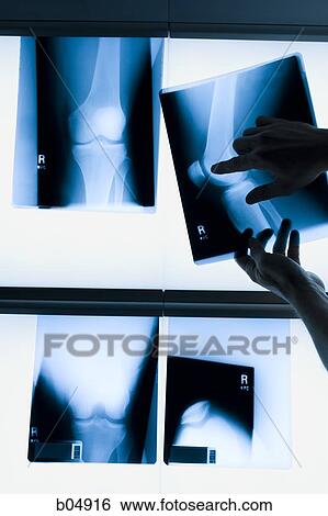 Male hands holding xrays View Large Photo Image Stock Photograph - Male hands holding xrays. Fotosearch