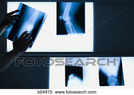 Male hands holding xrays View Large Photo Image Stock Photography - Male hands holding xrays. Fotosearch