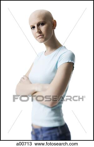 Stock Image - Bald woman. Fotosearch