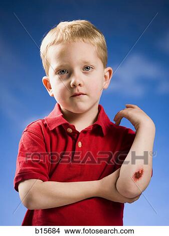 Picture - Boy with scraped elbow. Fotosearch