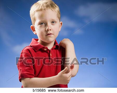 Boy with scraped elbow View Large Photo Image Stock Photography - Boy with scraped elbow. Fotosearch