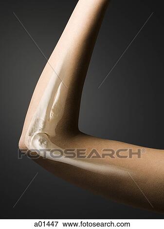 Female elbow with bones and joint View Large Photo Image Stock Photo - Female elbow with bones and joint. Fotosearch