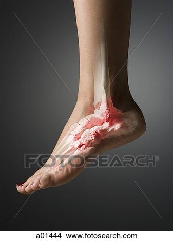 MRI-like image of foot with inflammation View Large Photo Image Picture - MRI-like image of foot with inflammation. Fotosearch