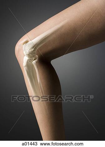 Woman's leg with knee and leg bones visible View Large Photo Image Stock Image - Woman's leg with knee and leg bones visible. Fotosearch
