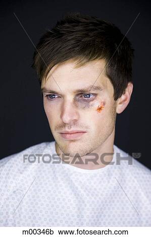 man in a hospital gown with a black eye View Large Photo Image Stock Image - man in a hospital gown with a black eye. Fotosearch