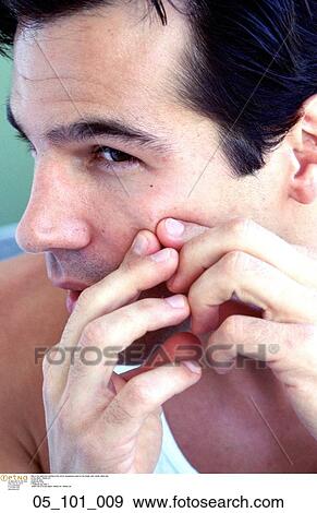 Stock Photo - squeezing, spot, his, cheak, vain. Fotosearch