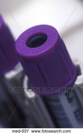 Close up of Medical Test Vial UK View Large Photo Image Stock Photo - Close up of Medical Test Vial UK. Fotosearch