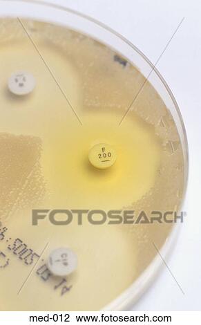 Close up of Petri Dish and Culture UK View Large Photo Image Stock Image - Close up of Petri Dish and Culture UK. Fotosearch