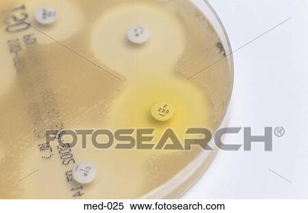 Close up of Petri Dish and Culture UK View Large Photo Image Stock Photography - Close up of Petri Dish and Culture UK. Fotosearch