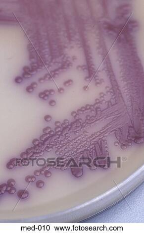 Culture in Petri Dish View Large Photo Image Stock Image - Culture in Petri Dish. Fotosearch