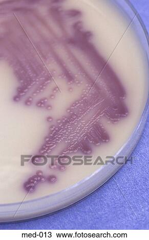 Stock Image - Culture in Petri Dish. Fotosearch