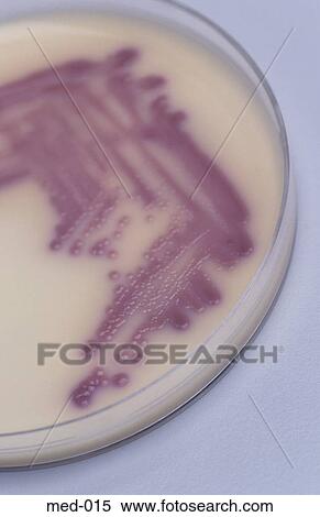 Stock Photography - Culture in Petri Dish. Fotosearch