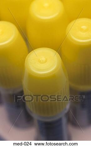 Medical Sample Containers UK View Large Photo Image Picture - Medical Sample Containers UK. Fotosearch