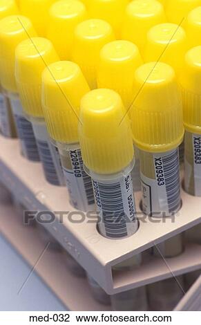 Medical Sample Containers UK View Large Photo Image Stock Image - Medical Sample Containers UK. Fotosearch
