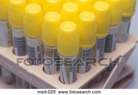 Stock Photo - Medical Sample Containers UK. Fotosearch