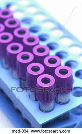 Medical Test Vials in Blue Rack UK View Large Photo Image Picture - Medical Test Vials in Blue Rack UK. Fotosearch
