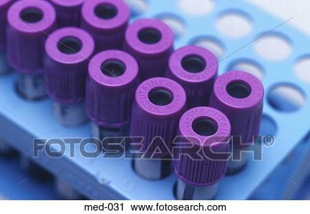 Medical Test Vials in Blue Rack UK View Large Photo Image Stock Image - Medical Test Vials in Blue Rack UK. Fotosearch