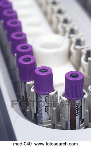 Medical Test Vials in Conveyor UK View Large Photo Image Stock Image - Medical Test Vials in Conveyor UK. Fotosearch