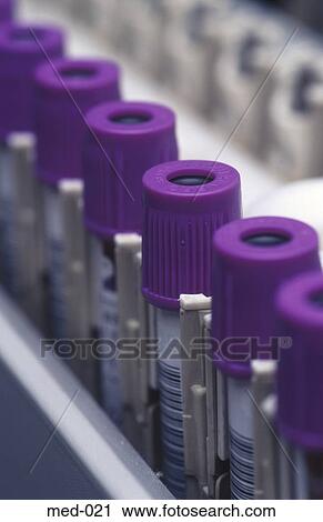 Medical Test Vials UK View Large Photo Image Stock Image - Medical Test Vials UK. Fotosearch