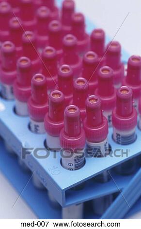Stock Photo - Tray of Test Vials UK. Fotosearch