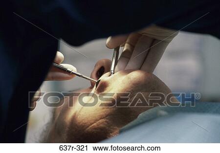 patient, dentist, health, medical, hygiene, dental View Large Photo Image Stock Image - patient, dentist, health, medical, hygiene, dental. Fotosearch
