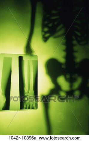 blur, skeleton, arm, health, medical, x-ray View Large Photo Image Stock Image - blur, skeleton, arm, health, medical, x-ray. Fotosearch