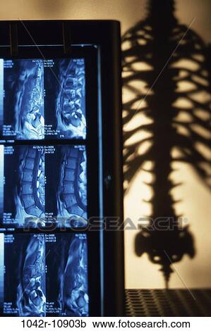 skeleton, health, medical, spine, x-ray, imaging View Large Photo Image Stock Image - skeleton, health, medical, spine, x-ray, imaging. Fotosearch