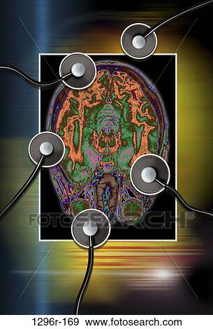Stock Photo - brain, health, mind, medical, stethoscopes, x-ray. Fotosearch