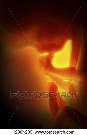 fetus, health, beginnings, pregnancy, medical, womb View Large Photo Image Stock Image - fetus, health, beginnings, pregnancy, medical, womb. Fotosearch