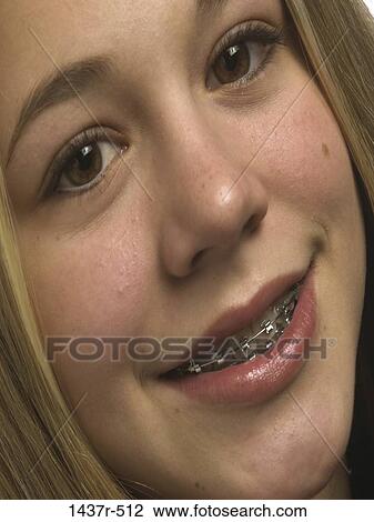 people, smiling, teeth, braces, confident, smile, blond View Large Photo Image Stock Image - people, smiling, teeth, braces, confident, smile, blond. Fotosearch