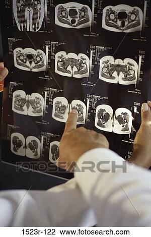 pointing, health, point, checking, check, medical View Large Photo Image Stock Image - pointing, health, point, checking, check, medical. Fotosearch