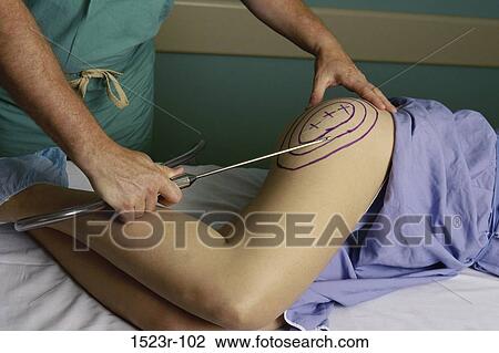 testing, patient, surgery, doctor, health, legs View Large Photo Image Stock Image - testing, patient, surgery, doctor, health, legs. Fotosearch