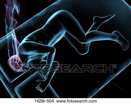 Illustration of a man sleeping with brain highlighted View Large Photo Image Picture - Illustration of a man sleeping with brain highlighted. Fotosearch