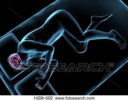 Stock Image - Illustration of a man sleeping with brain highlighted. Fotosearch