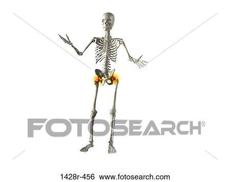 X-ray view of a human skeleton with hip joint inflammation View Large Photo Image Stock Photograph - X-ray view of a human skeleton with hip joint inflammation. Fotosearch