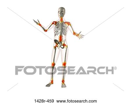 X-ray view of a human skeleton with joint inflammations View Large Photo Image Stock Photo - X-ray view of a human skeleton with joint inflammations. Fotosearch